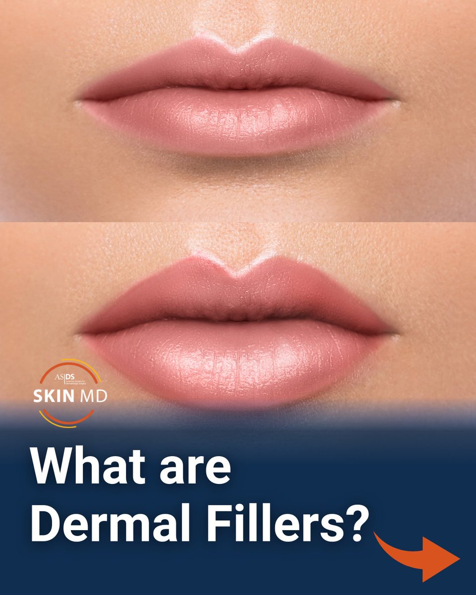 ASDS Skin MD tweet media