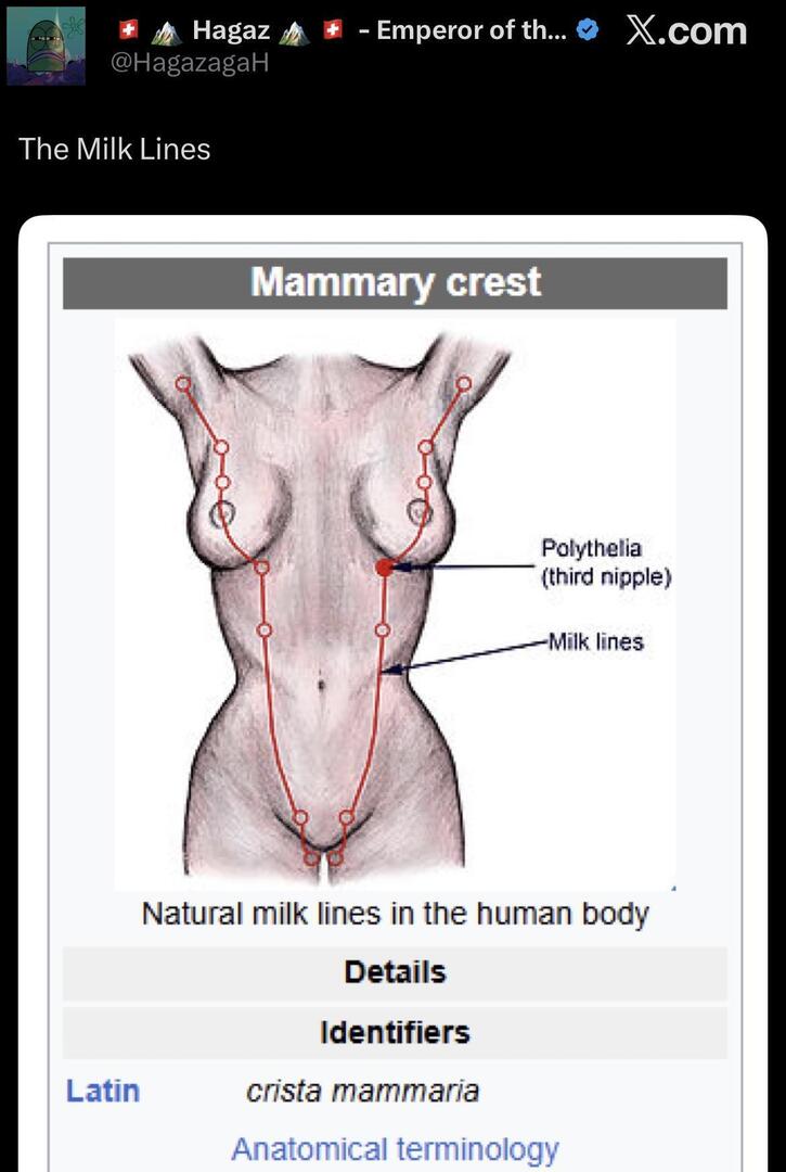 W baru tau njir ada yg namanya milk lines, cb kalian cek dh ada bintik hitam/tahi lalat gk di bagian” ini 💚