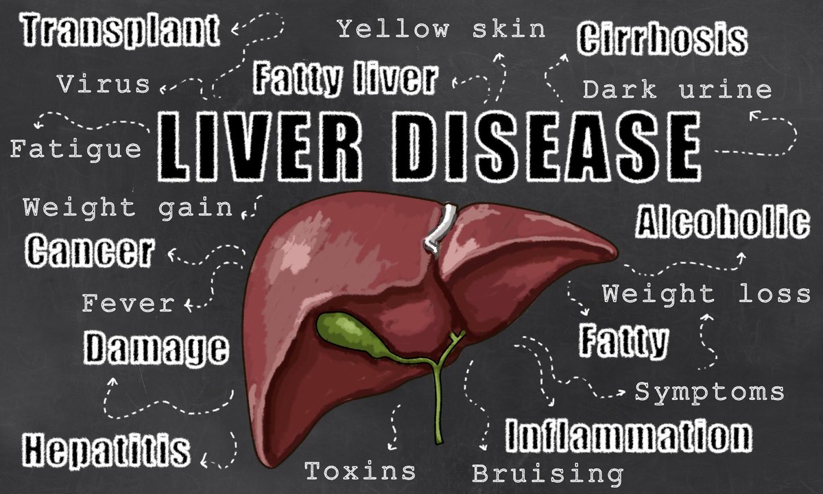BlueFaeryLiver's tweet photo. Targeting ETV5 May Slow Tumor Progression in Hepatocellular Carcinoma https://t.co/xJDMwXsxws #liverhealth #livercancer #liverdisease https://t.co/NHnoZfqjP8
