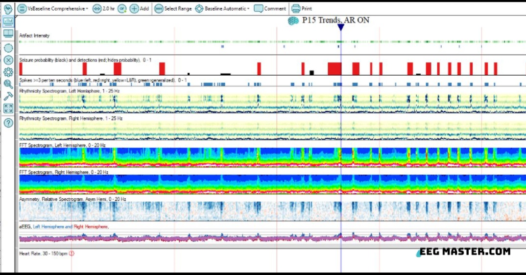 EEG Master tweet media