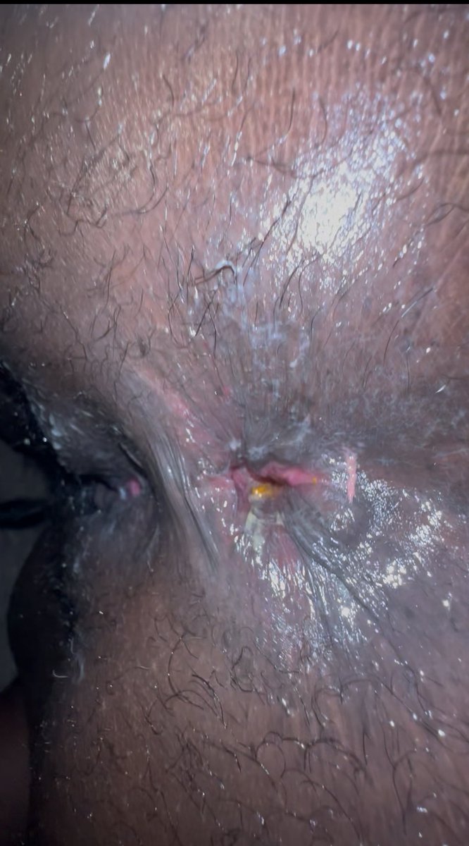 peanutbuttahole tweet media