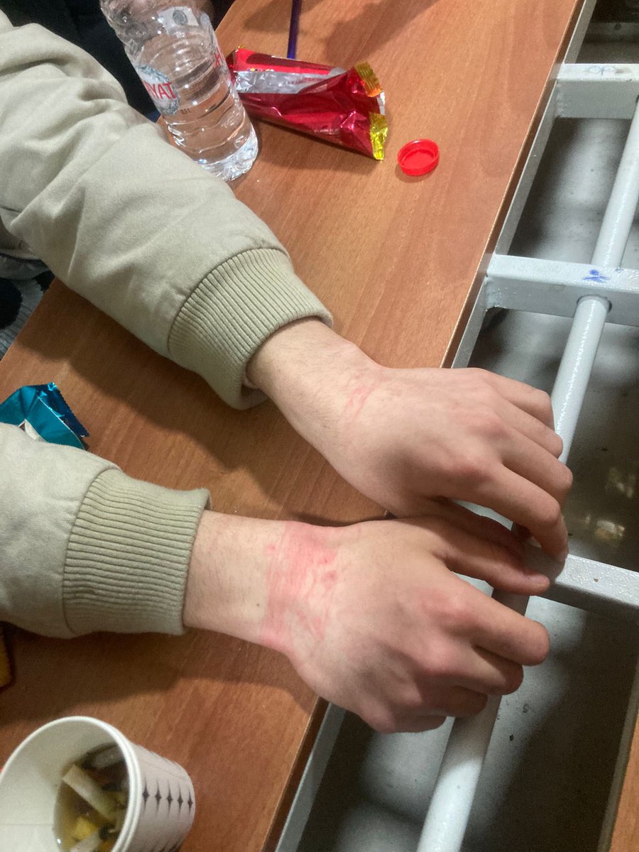 GÖZALTINDA İŞÇİYE TERS KELEPÇE VARSA DİRENİŞTE TAVİZ YOK!

Meşru taleplerimiz için muhatabımız Migros patronu Tuncay Özilhan’ın evinin önüne gittik. Kaymakam emriyle işçiler ve sendika yöneticilerimiz ters kelepçeyle işkence edilerek gözaltına alındı. Biz vazgeçmeyeceğiz!