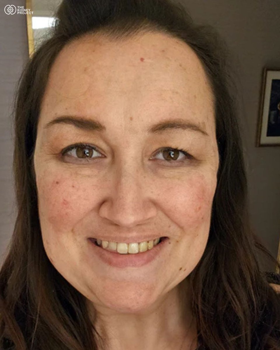 The Kidney Project tweet media