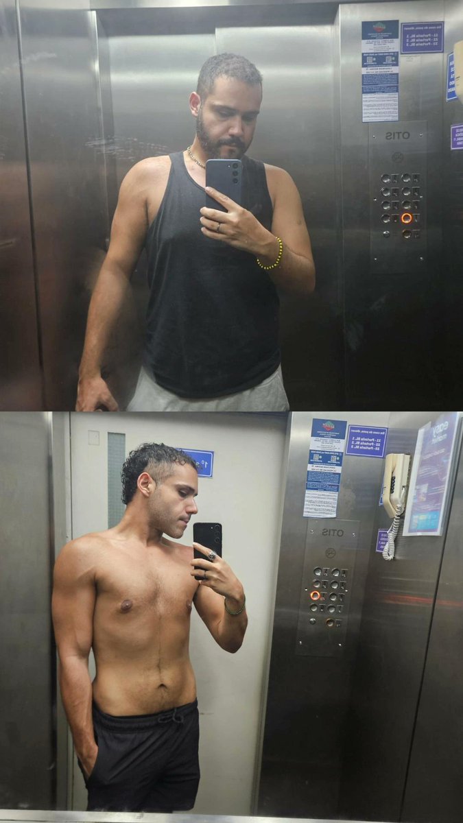 1 ano de diferença entre as fotos