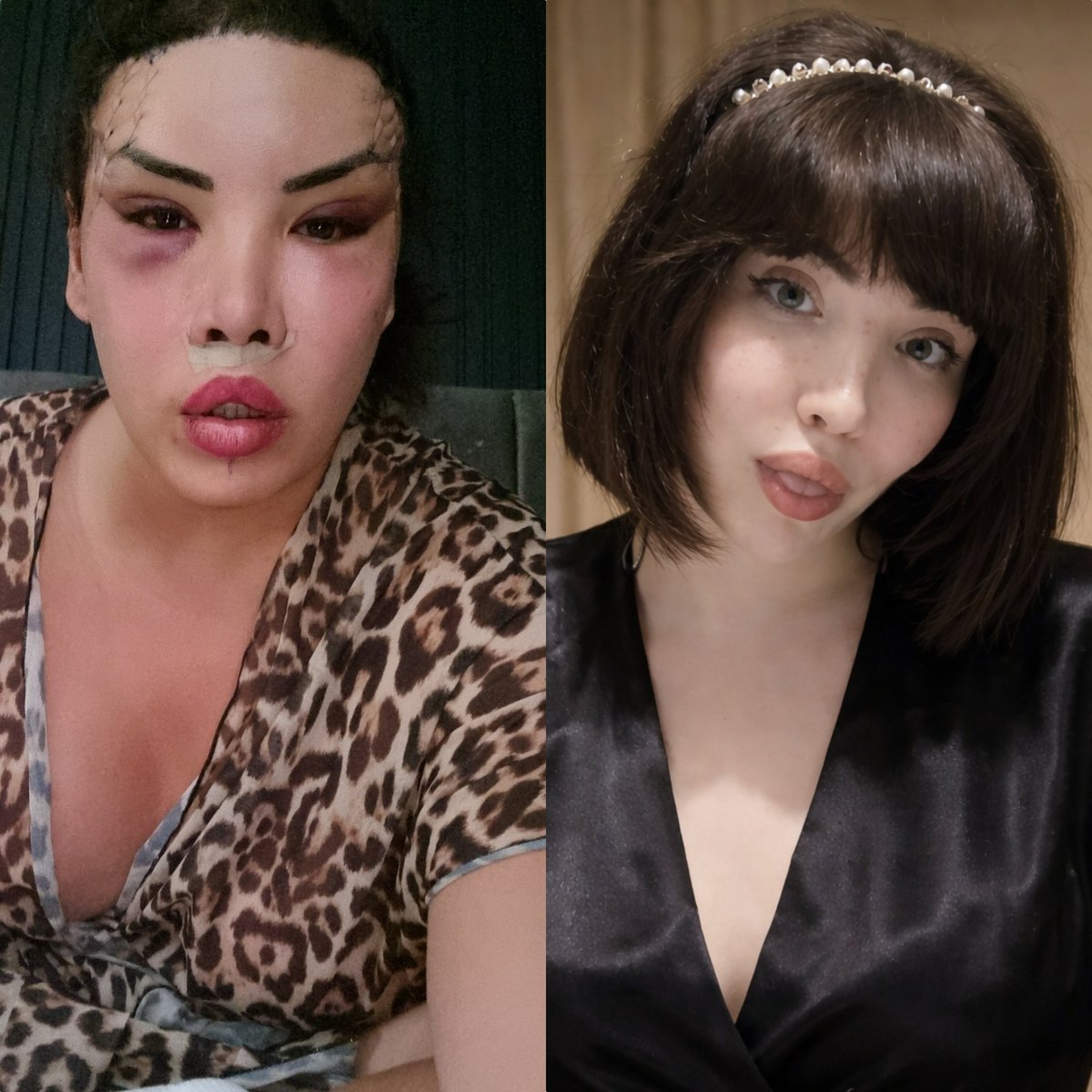 BᎥოცᕱ BᕱᏒ꒝ꂅLԾภᕱ® tweet media