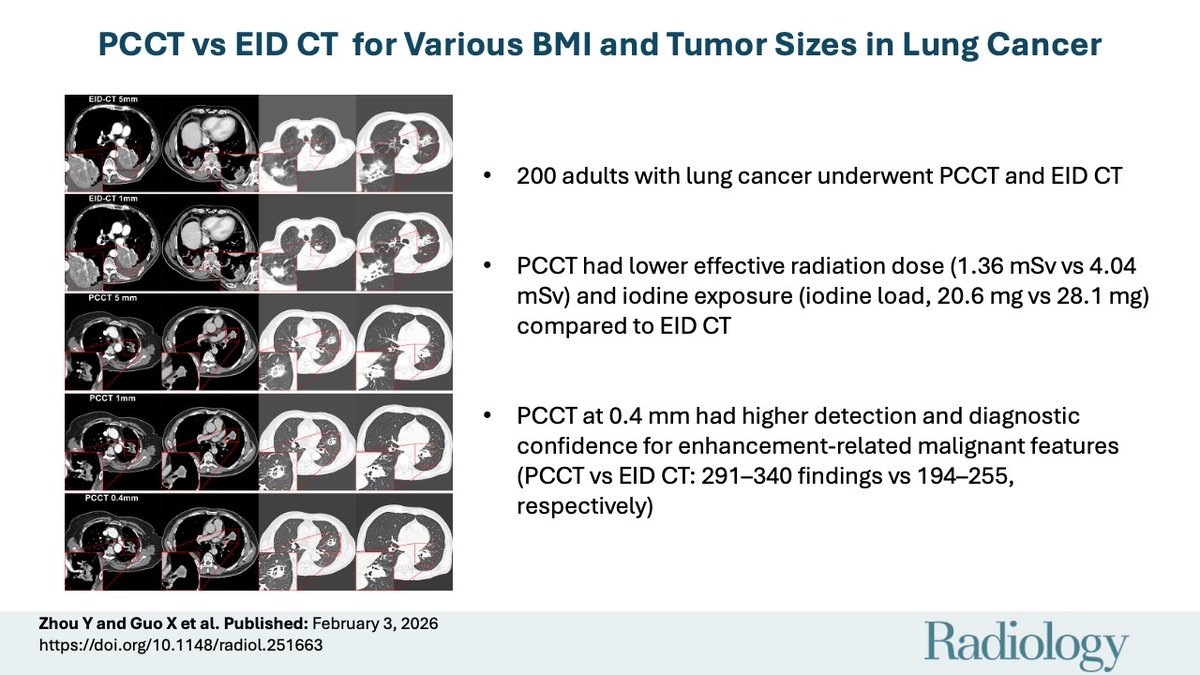 1/10 Can photon-counting CT outperform conventional CT in #LungCancer 🫁 while cutting radiation &amp; contrast? 
🚨 New study in @Radiology_RSNA #RadInTraining #Tweetorial 
👉 pubs.rsna.org/doi/10.1148/ra…
<a href="/RadiologyEditor/">@RadiologyEditor</a> <a href="/RITEditor/">Rad In Training Editor</a> <a href="/VChernyakMD/">Victoria Chernyak, MD MS FSAR FESGAR FACR</a> <a href="/SuhnyAbbara/">Suhny Abbara MD, FACR, MSCCT, FNASCI</a> <a href="/chemshift1/">kathrynfowler</a> <a href="/ProfVickyGoh/">Vicky Goh</a>