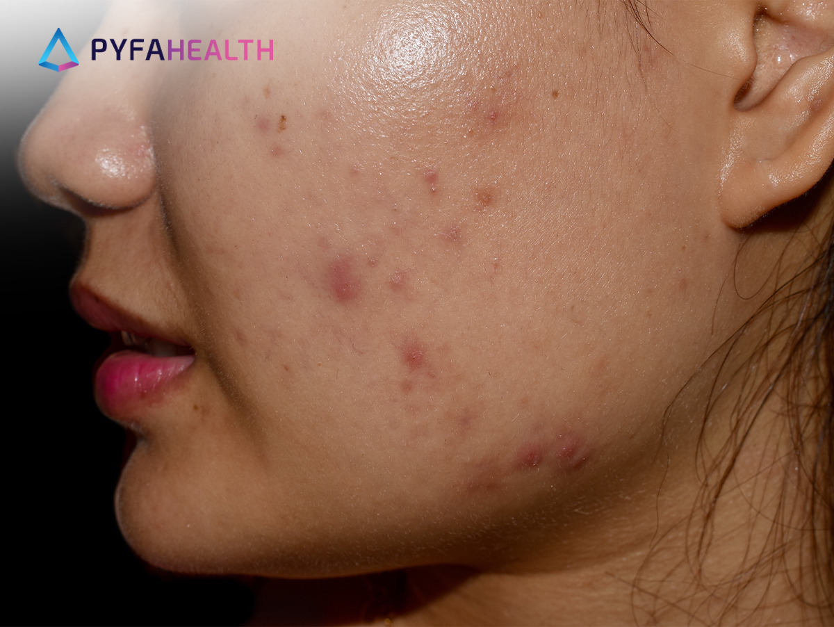 ✨OMBB | 🚫NO LINK tweet media