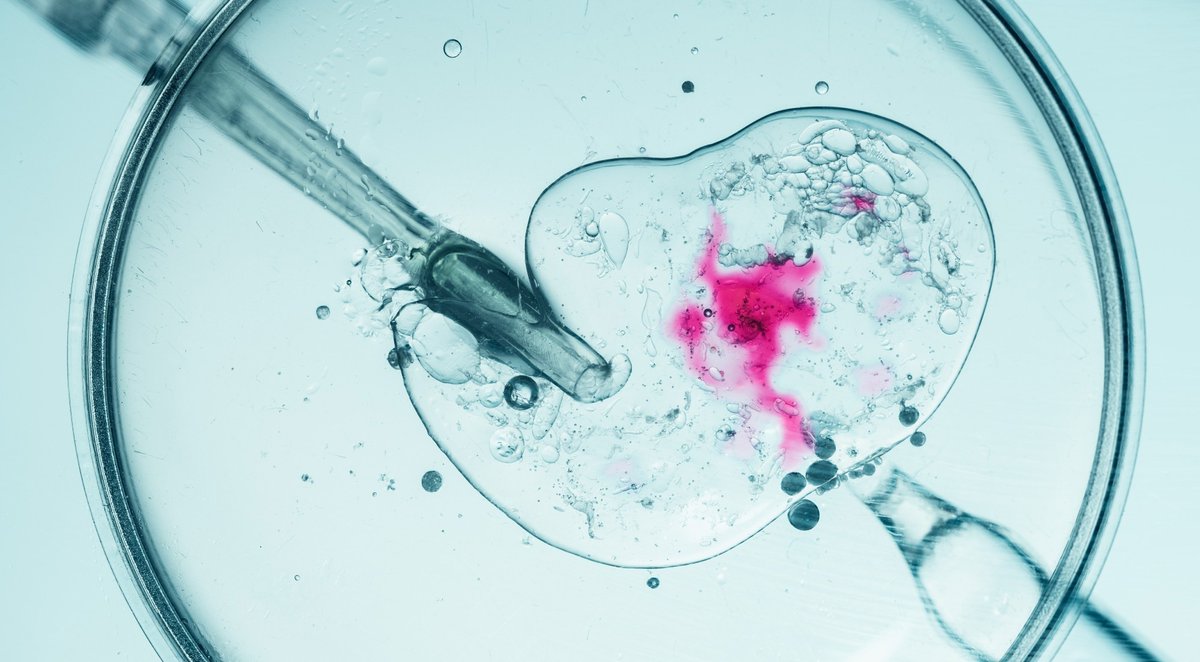 NewsMedical's tweet image. New IVF research reveals: shorter insemination time can protect embryo availability without reducing live birth success. Hope for patients with limited oocyte yield! 👶🔬 Read more: news-medical.net/news/20260204/… #IVF #Fertility #ReproductiveHealth @FrontEndocrinol