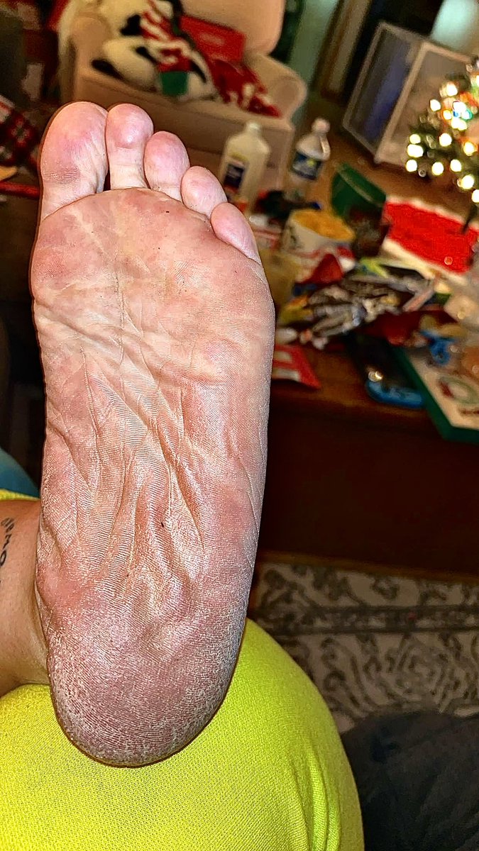 solee_purposeee's tweet photo. Anyone like thick gorgeous bbw soles? Let me know what you think and maybe she’ll make her own page. #bbw #soles https://t.co/HcxdsIuPmW