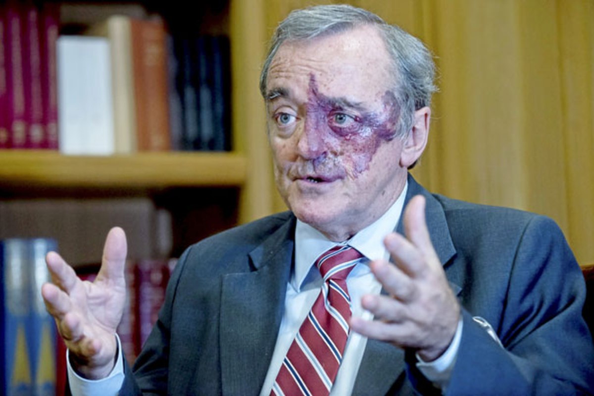 Él es Mariano Barbacid, investigador de CRIS Contra el Cáncer que junto a su equipo ha conseguido curar el cáncer de páncreas en ratones, lo cual supone un avance vital en el estudio de este tipo de tumor.

En la actualidad, el 95 % de los pacientes con cáncer de páncreas no