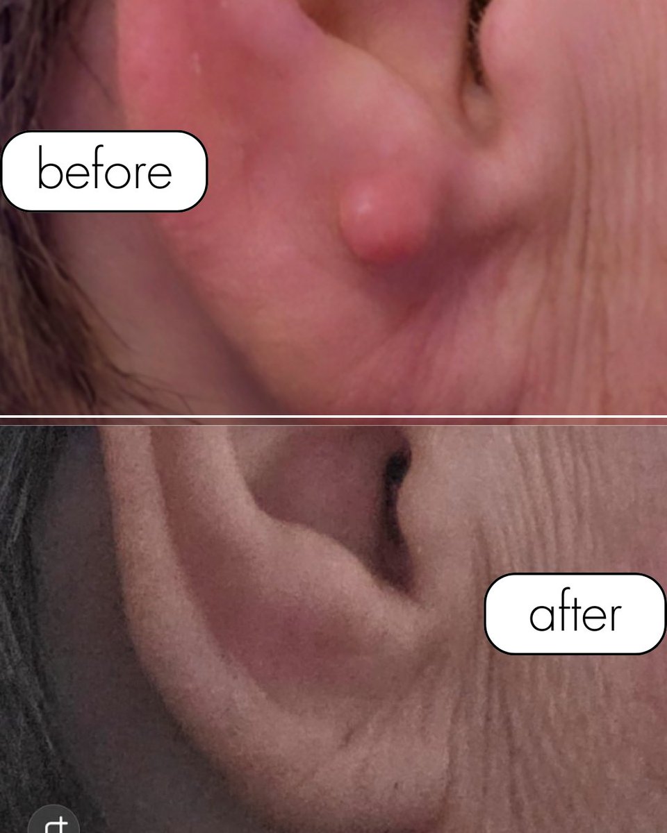 Astounding Skin Aesthetics tweet media