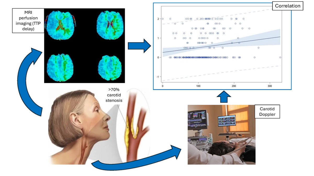StrokeAHA_ASA's tweet photo. Simultaneous publication at #ISC26 🔴: In the CREST-H study, among patients with high-grade asymptomatic carotid stenosis, higher end-diastolic flow velocities correlated with delayed cerebral perfusion. @AHAScience https://t.co/XUgSN8mF3H https://t.co/2Jepywae0E