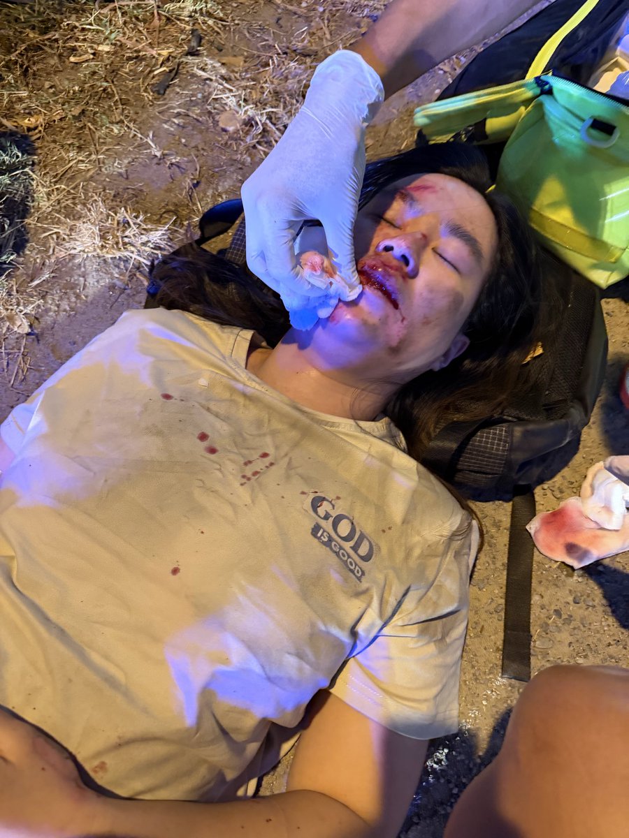 ขอความช่วยเหลือจากผู้ที่อยู่ในเหตุการณ์หรือมีกล้องหน้ารถ 🙏🏼

เฟอร์ประสบอุบัติเหตุรถมอเตอร์ไซค์ล้ม ได้รับบาดเจ็บค่อนข้างสาหัส

📅 วันเกิดเหตุ: วันอังคารที่ 3 กุมภาพันธ์ 2569
⏰ ช่วงเวลา: ประมาณ 18:40 – 18:44 น.
📍 สถานที่: ถนนศรีสุนทร เลยร้าน หอยแซ่บ ประมาณ 500 เมตร