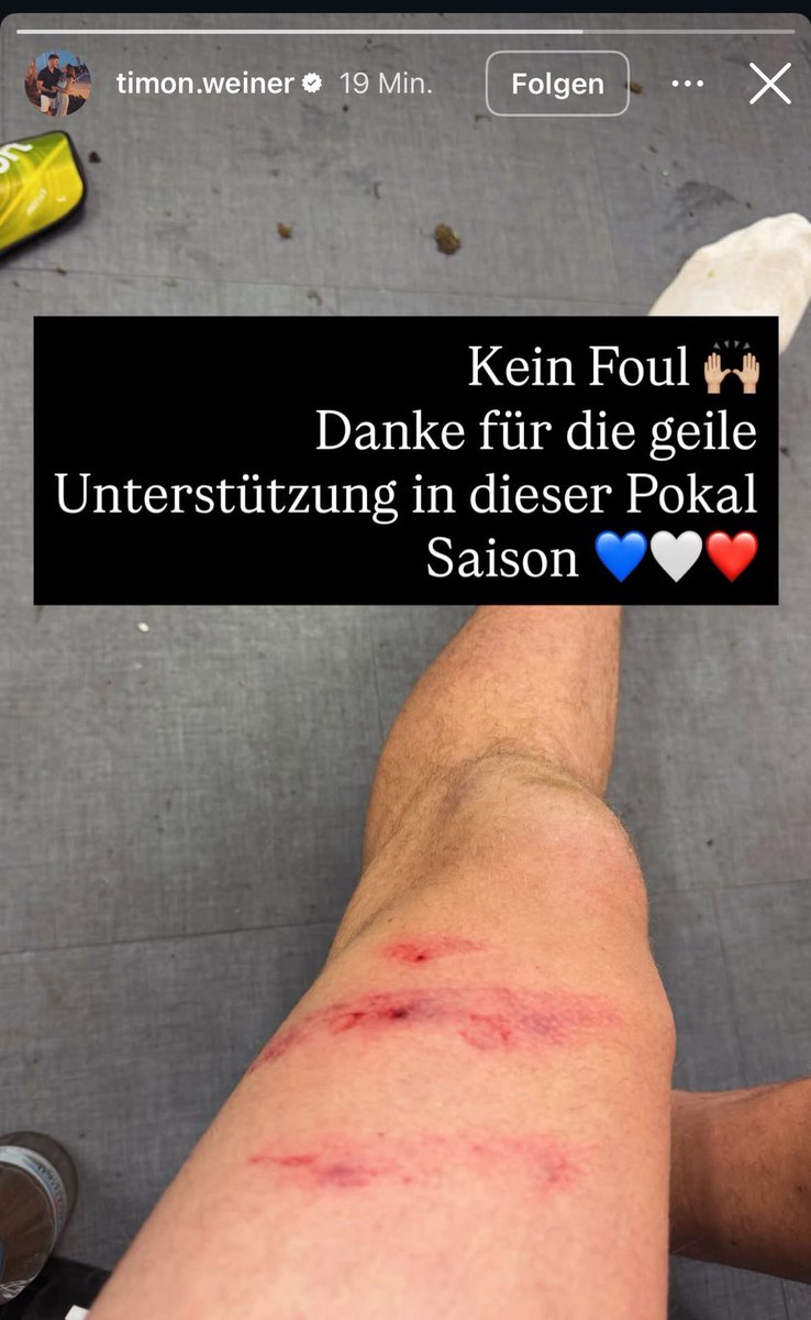 RedEvolution96's tweet image. War halt auch kein Foul #KSVVFB