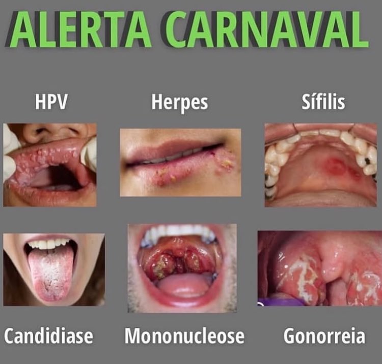 euwandson's tweet image. 