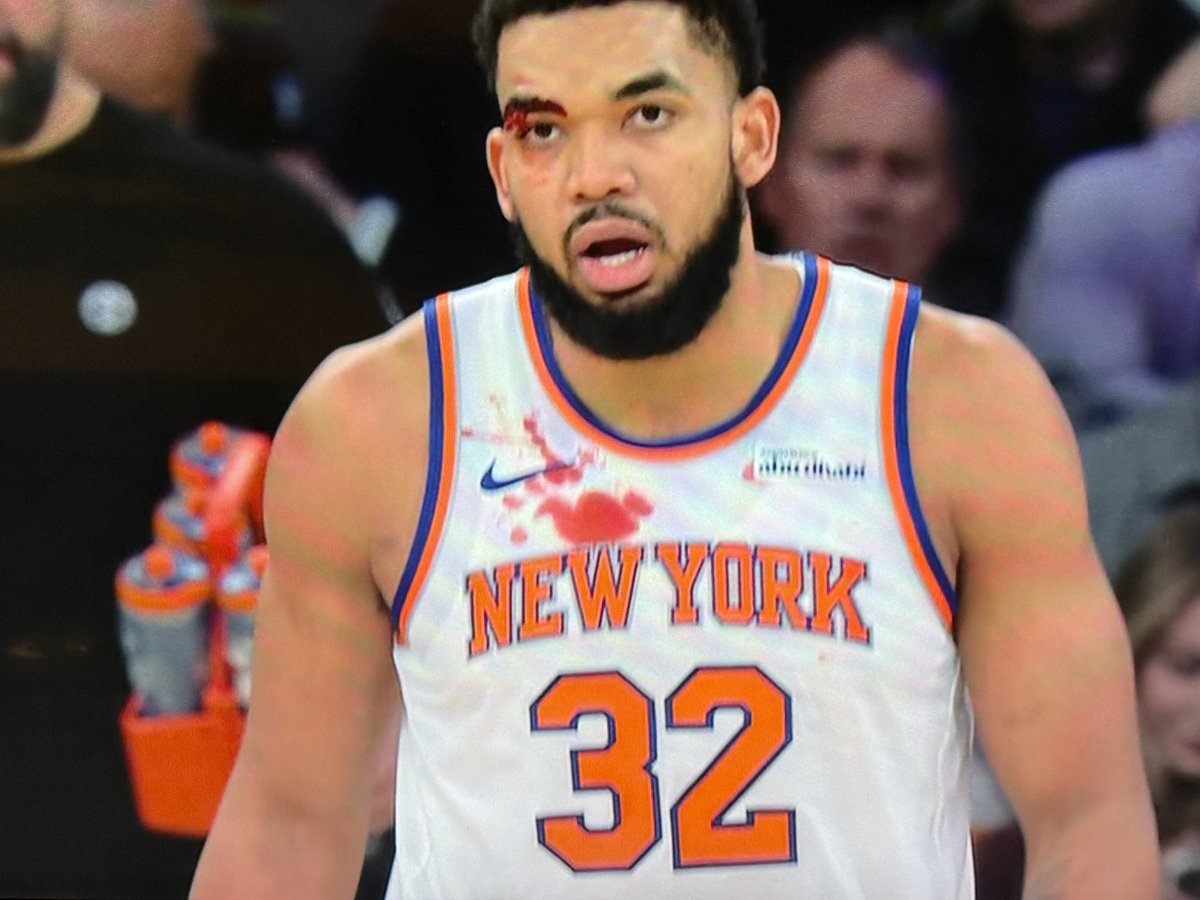 Ouch 🤕 #kat #knicks