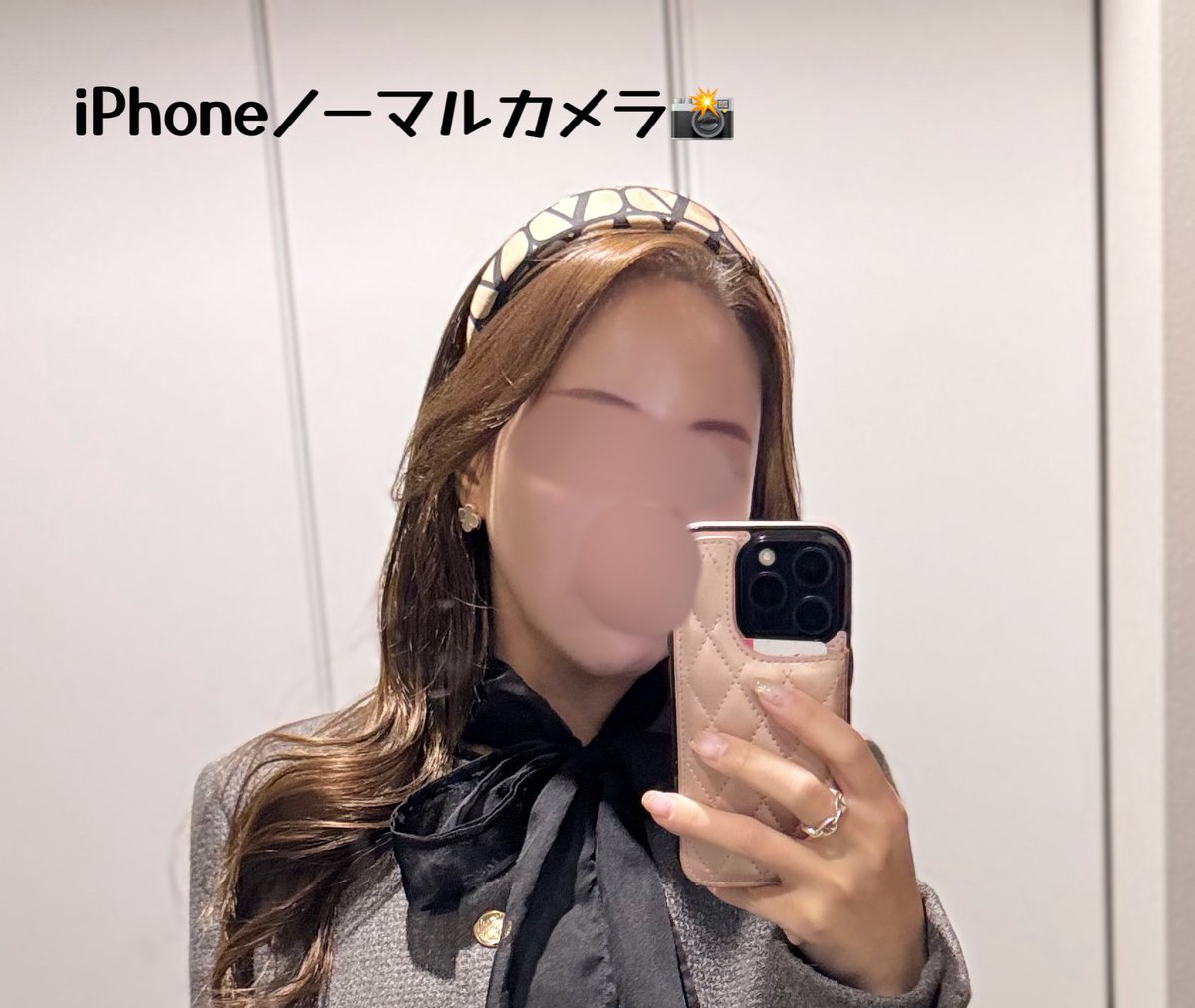 pannasan33's tweet photo. 『江南📍ダブルM』12月に続きまたまたリピ （@doublemjpn/@mnmclinic）

したのは☑️セリニュー300ショット！！
去年一度セリニューした事があって、めっちゃ良かった記憶で❗️😌またしたいと思ってて🥰今回施術提供して頂きました✨

今で10日ほど経過したけど、１週間くらいから、あれ？なんかしたっけ？セリニューだ！って感じました😂ノーマルカメラでもフェイスラインがピタッと盛れる感じがして嬉しい😭❤️w

オリジオよりも強力と言われているセリニュー🤭
セリニュー置いてるところ少ないよね？😭
私はほうれい線、下顔面中心に300ショットしました❗️麻酔クリームをしてから施術なので、痛みに弱い人でもいけそう！！最後らへんになってくると所々は熱かった！人によっては痛いと感じるのかな🥺

コケずに下顔面がキュッと引き締まった感じがするセリニューが、個人的には高周波の中で一番好きで最近の中で一番効果感じてる🤭🤭(リアルです)

丁寧かつ、いつも１時間ほどで出れてバタばかり渡韓民に本当に助かってます😭😭✨w

#DOUBLEMJPN #ダブルM #韓国綺麗になる
#韓国美容施術　#江南皮膚科 #韓国皮膚科　#韓国クリニック　#韓国美容　#韓国肌管理