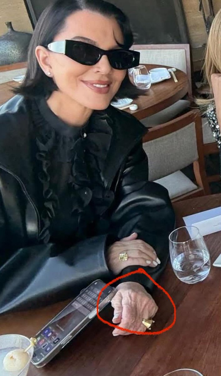 Kris Jenner siempre usa guantes, la cirugía plástica le estiró la cara, pero no las manos.