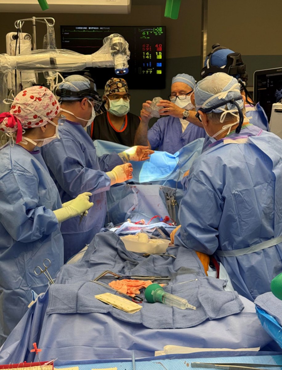 RCubedduMD's tweet image. Heroic save following AMI Shock in a patient with double insult: ventricular pseudoaneurysm and VRS.  #innovation #heartteam @NCHRooneyHeart @JACCJournals #Shock #AMI @ACCinTouch @JACCJournals @DeeDeeWangMD @PU84  @DrBrianSolomon 
sciencedirect.com/science/articl…