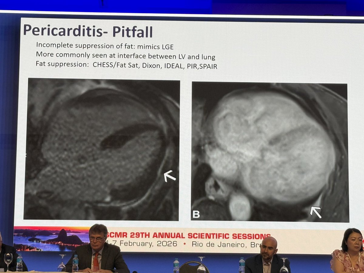 ydaryani's tweet photo. Excellent overview of pericardial disease in today’s program &amp; #whyCMR #SCMR2026 @SCMRorg 

Social media handles of the #SCMR2026 ambassadors for tagging

@vass_vassiliou, @vineetao17, @DrJenniferCo_Vu, @JStojanovskaMD, @purviparwani, @Kfarooqi, @MansiV1991, https://t.co/X8Yita815P