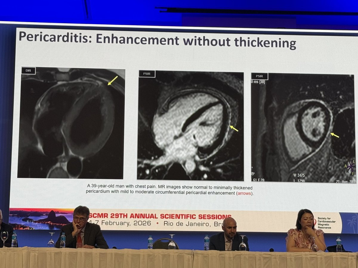 ydaryani's tweet photo. Excellent overview of pericardial disease in today’s program &amp; #whyCMR #SCMR2026 @SCMRorg 

Social media handles of the #SCMR2026 ambassadors for tagging

@vass_vassiliou, @vineetao17, @DrJenniferCo_Vu, @JStojanovskaMD, @purviparwani, @Kfarooqi, @MansiV1991, https://t.co/X8Yita815P