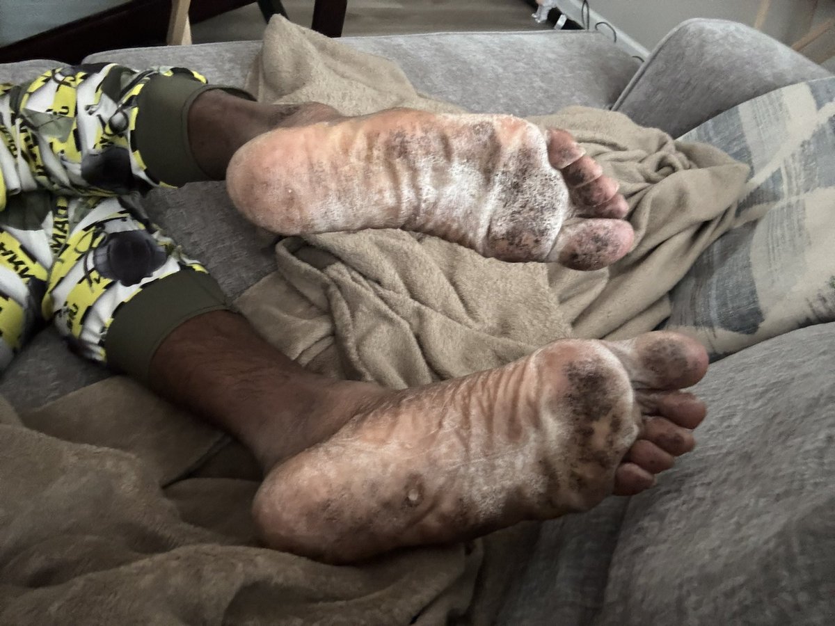 adidas8boots's tweet photo. Walking around my homies house 👃🏾😈😂 https://t.co/peVVFsi41C