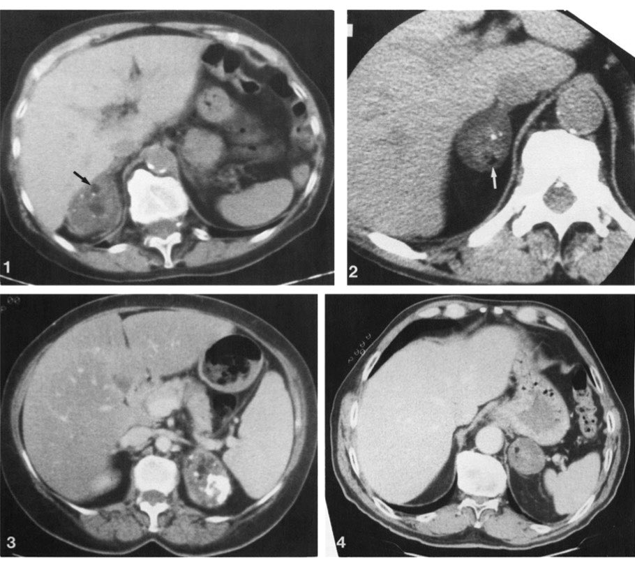 Neil Rofsky, MD, MHA tweet media