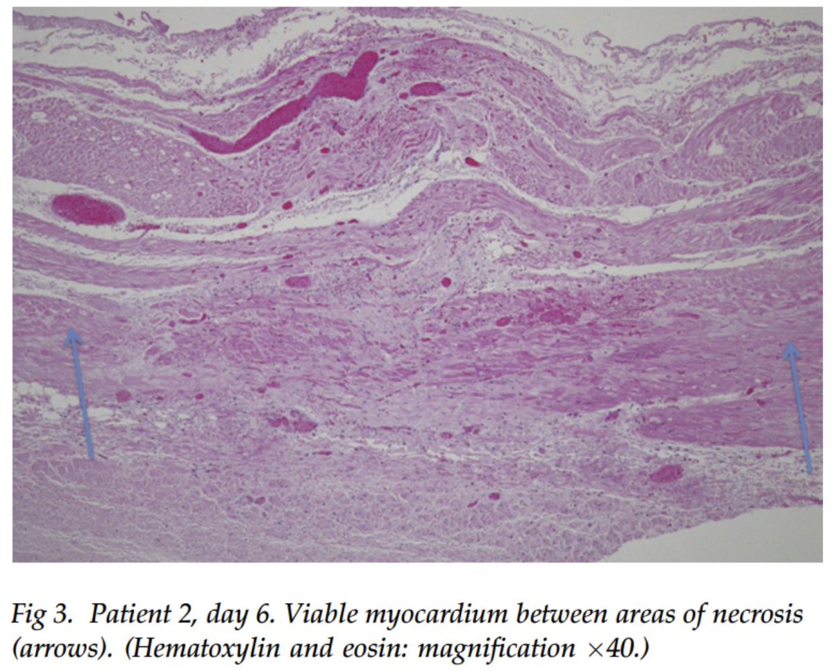 EHRAPresident tweet media