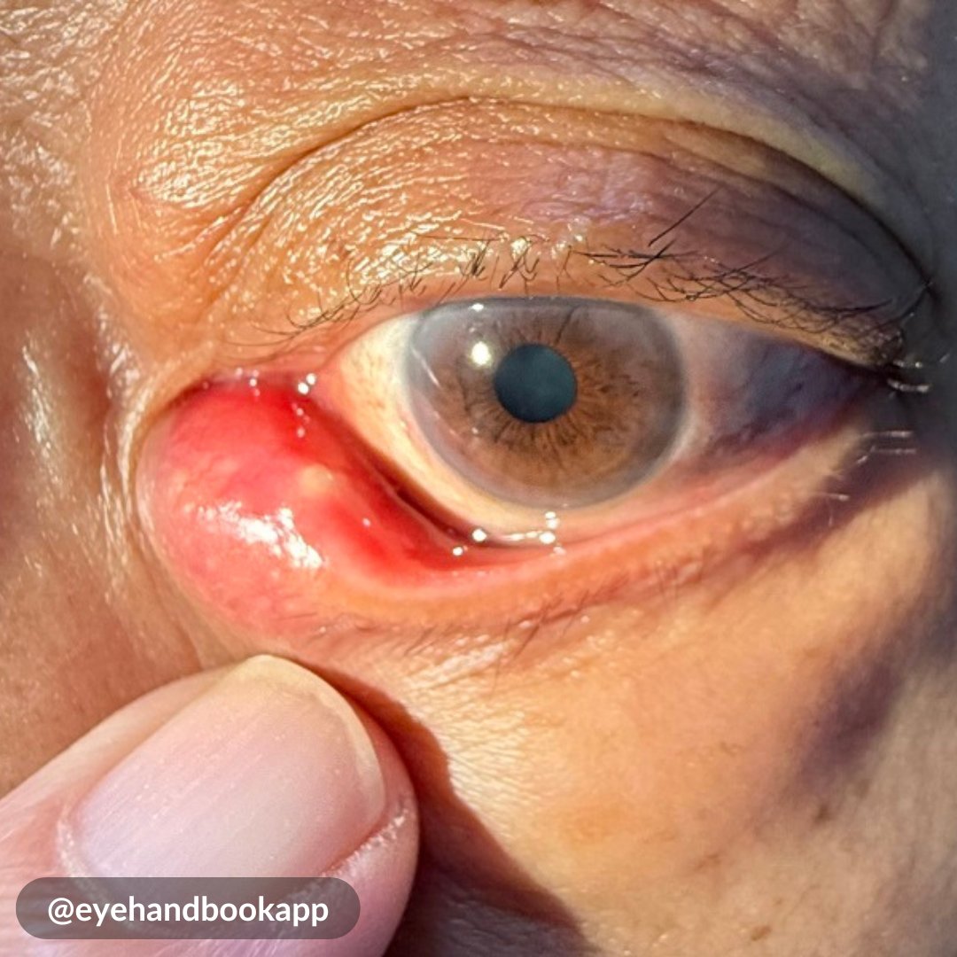 Eye Handbook tweet media