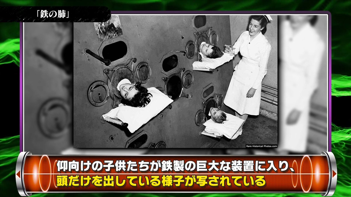 kirinjijineta's tweet photo. 【死ぬまでに1度は見ておくべき衝撃写真4選】

①戦場のクリスマス
■概要
・1914年12月、第一次世界大戦中に撮影
・敵同士であるドイツ兵とイギリス兵が寄り添い合う

■背景
・戦争開始から初めてのクリスマス
・兵士たちは自発的に一時停戦
・煙草や菓子を交換
・サッカーを楽しみ、クリスマスソングを合唱
・砲弾と死体に囲まれた戦場で
　この日だけは敵味方を忘れ、人として向き合った
・翌日から再び戦闘が再開された

②テレスカ・トレスの「家」
■概要
・1948年、雑誌「Life」に掲載された写真
・少女が黒板に乱雑な線を描いている様子が写る

■少女について
・少女の名はテレスカ
・第二次世界大戦で家族と家を失う
・爆撃による破片で中枢神経に深刻な損傷
・その後、ナチスの強制収容所に送られる

■背景
・戦後に孤児院で「家を描いて」と言われた際の一枚
・テレスカは「家」という概念を認識できなくなっていた
・引きつった表情のまま黒板にただ曲線を引き続けた

③売られる子ども
■概要
・1948年、アメリカ・シカゴで撮影
・「4人の子供を売ります」と書かれた看板
・母親が顔を隠し、子供たちが並ぶ写真

■背景
・第二次世界大戦後、アメリカは深刻な貧困状態
・工場閉鎖により職を失う家庭が続出
・子供たちは1人あたり約2ドルで売られていた

■過酷な現実
・親たちは
「このままでは飢えさせてしまう」
「裕福な家庭で生きてほしい」
という思いから、断腸の思いで子供を手放していた
・写真は“残酷さ”と同時に“親の愛情”も映している

④鉄の肺
■概要
・1950年代に撮影された一枚
・子供たちが巨大な鉄製装置に入り、頭だけを外に出している

■背景
・この装置は「鉄の肺」と呼ばれる人工呼吸器
・自力で呼吸できなくなる病気「ポリオ」患者用の医療機器
・装置内の圧力を変化させ、強制的に呼吸を行わせる仕組み

■残酷な現実
・治療中は日常の大半をこの状態で過ごす必要があった
・治療を続けても多くは10歳前後で死亡
・親たちは
①我が子の自由と引き換えに10年の命を得るか
②短い自由と引き換えに死を受け入れるか
という過酷すぎる2択を迫られた