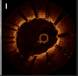 Cath Lab Digest tweet media