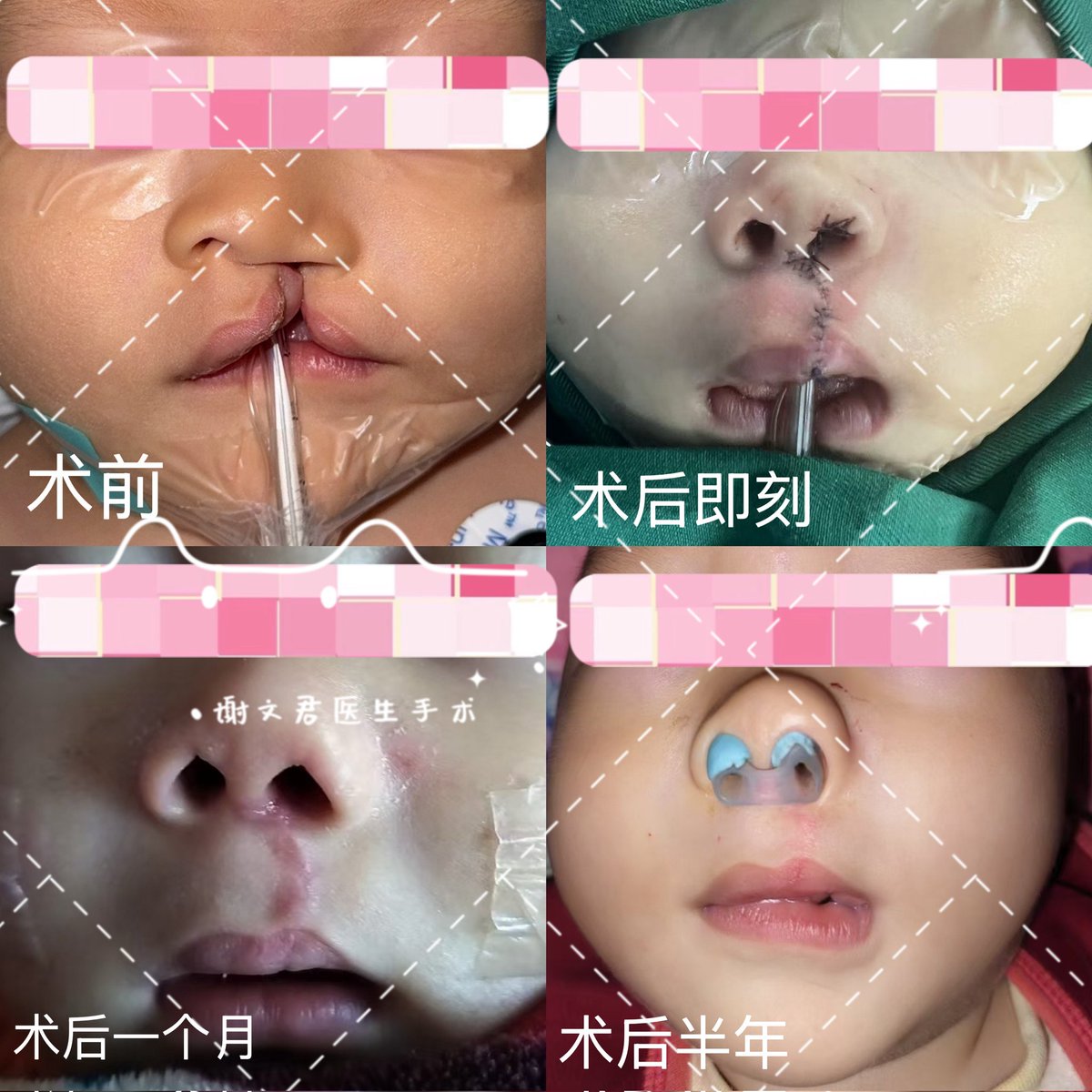 Jingdu Children Hospital tweet media