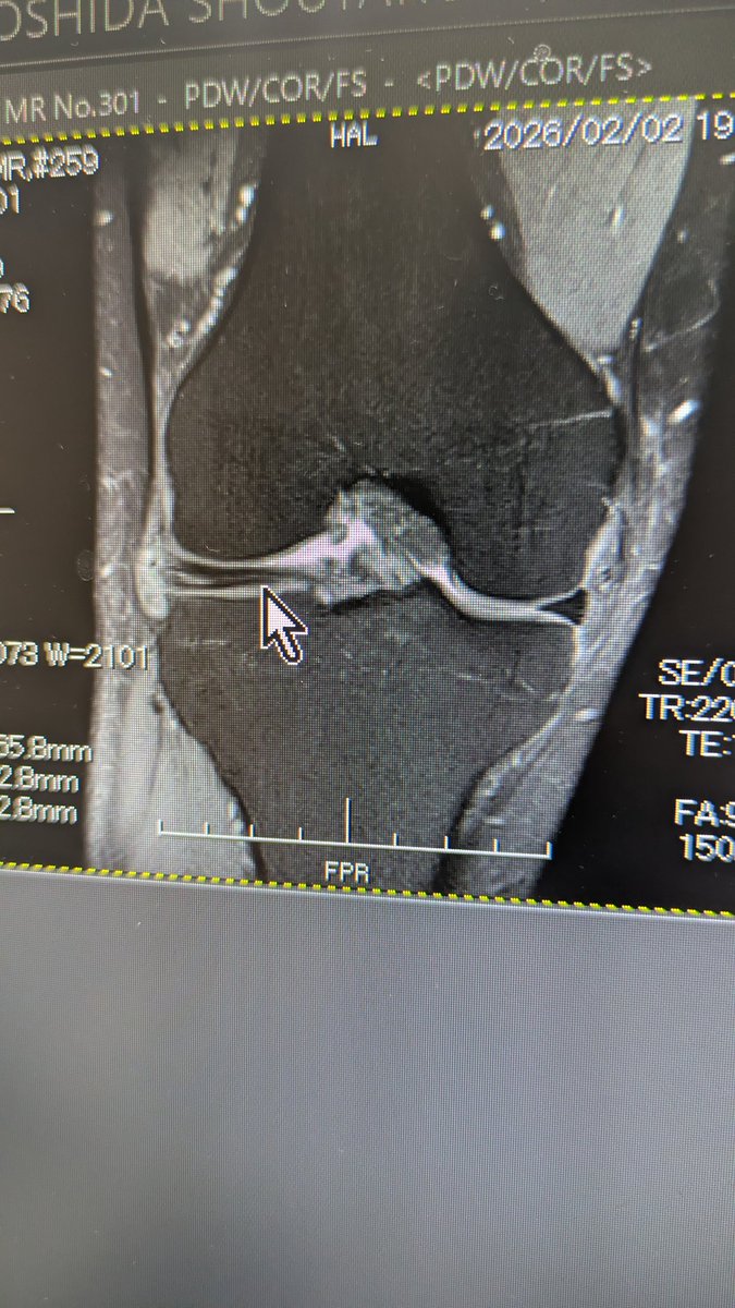 Shotaro∧C3←半月板ダリング待ち tweet media