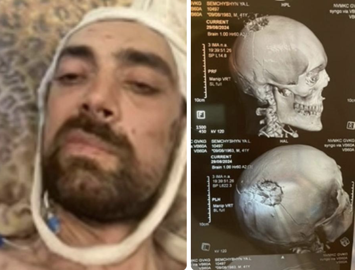 CITIZEN🌎ГРОМАДЯНИН🇺🇦 tweet media