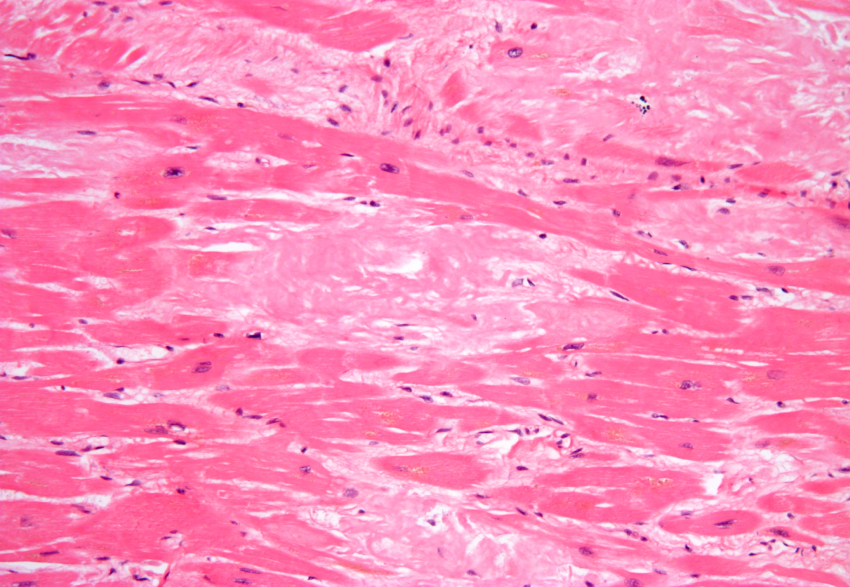 Infosalut tweet media