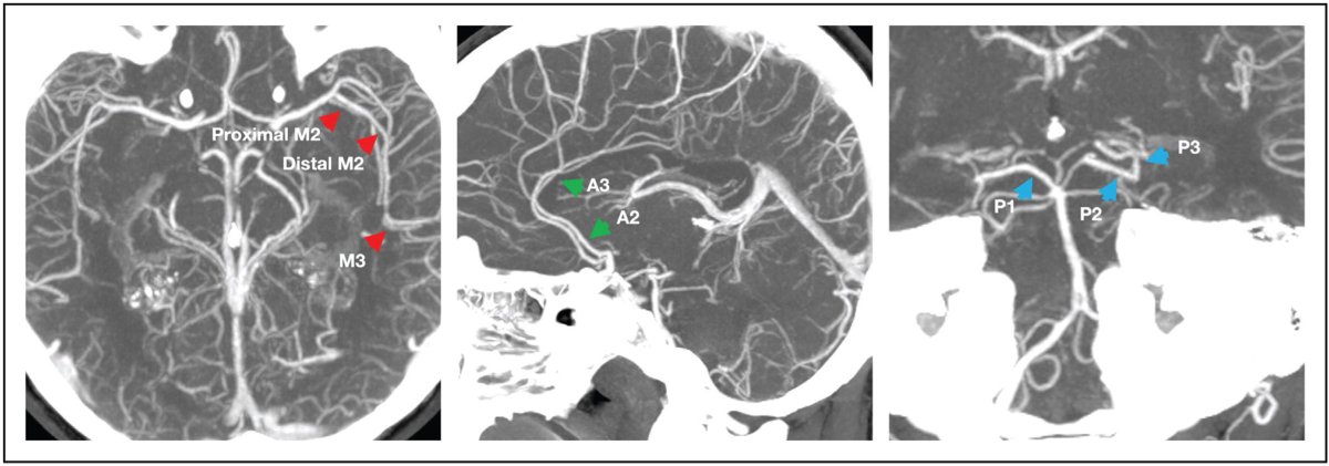 CO Neurology tweet media