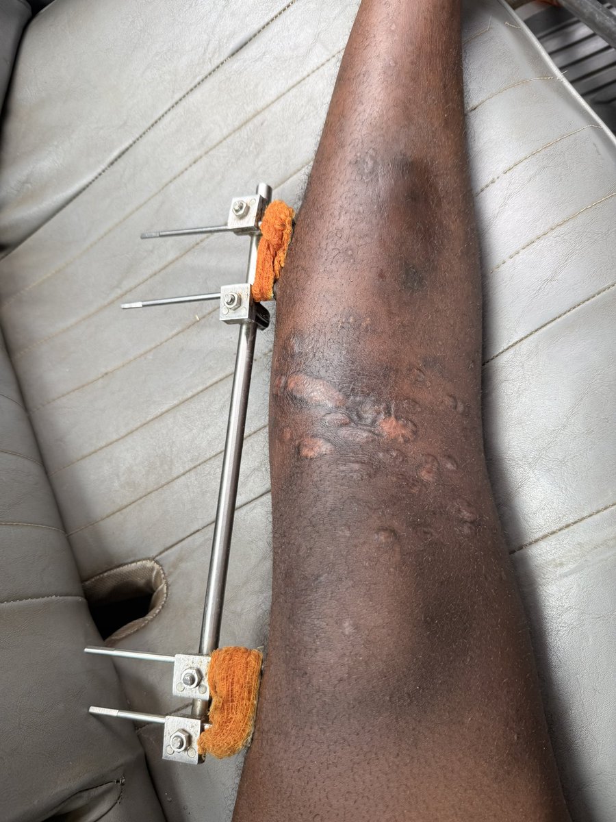 Medzonetv's tweet photo. Identify this device: https://t.co/JpSX9t6kVq