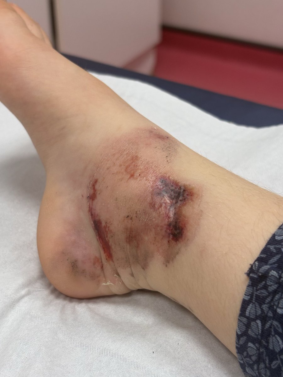 🚲 −··· ·· −−− −·· ·· ···− · ·−· ··· ·· − ··−·· 🚲 tweet media