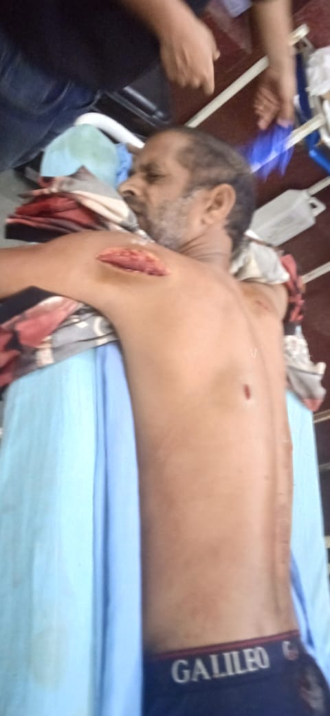 प्रेम पिता मांगीलाल सवीना उदयपुर  का मामला हे सुबह 4बजे  काम से घर  से निकला किसी अज्ञात  व्यक्ति ने चाकू ताबड़तोड़ वार किए सही समय पर इलाज नहीं मिला डॉक्टर की लापरवाही से आदिवासी भील युवक  की मौत हो गई  प्रसासन जल्द न्यायिक कार्यवाही करे 
<a href="/RajCMO/">CMO Rajasthan</a> 
<a href="/RajPoliceHelp/">Rajasthan Police HelpDesk</a> 
<a href="/UdaipurPolice/">Udaipur Police</a>