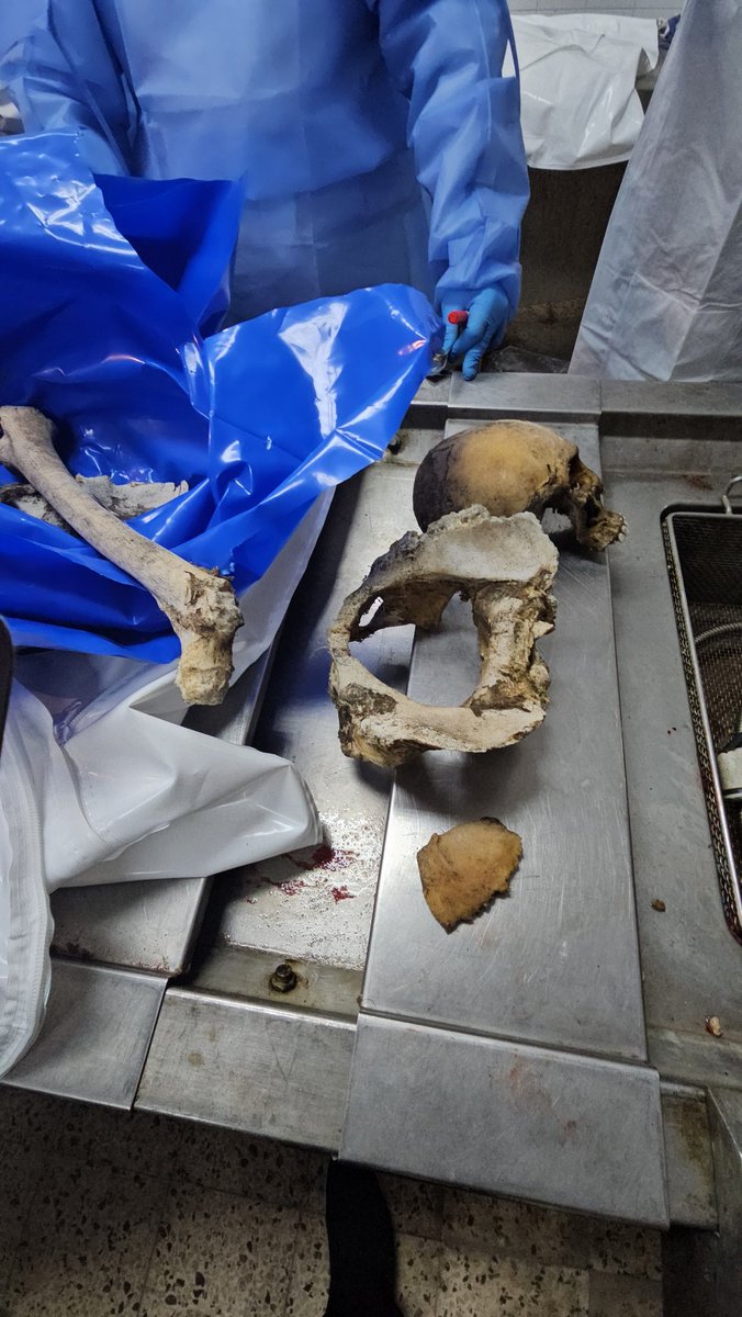 غزة تستلم بقايا أبنائها… والعالم يصمت

هذه ليست صورة عابرة،
ولا مشهدًا طارئًا في نشرة أخبار.
هذه بقايا إنسان.
عظامٌ منفصلة،
أطرافٌ بلا أسماء،
وأجسادٌ لم تُعاد كما خرجت من بيوتها،
بل كما أراد لها القتل أن تُمحى.
وصل إلى مجمع الشفاء الطبي قبل قليل 54 جثمانًا،
وترافقها 66 صندوقًا