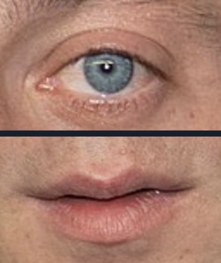 ProtonInspector's tweet image. Jeremy Allen White cast as Polyphemus in Nolan’s 2026 adaptation of The Odyssey