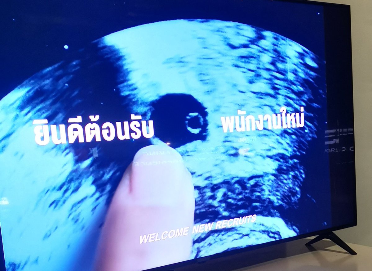 a_antmodd's tweet photo. หนังก็อิมแพคเกิน! อีเวรรรร
กูผู้ซึ่งหางานใหม่อยู่ตอนนี้ หดหู่ใจมากค้า
มองอีกมุม หนังมันไม่ได้สร้างขึ้นมาเพื่อเราคนเดียว นั่นก็หมายความว่ามีผู้คนอีกไม่รู้เท่าไหร่ที่ตกอยู่ในสถานการณ์เดียวกับเราหรือตัวเราเองควรยอมรับกับมันว่ะ T T

#พนักงานใหม่โปรดรับไว้พิจารณา
#HumanResourceMovie https://t.co/zqDRU9BxW1