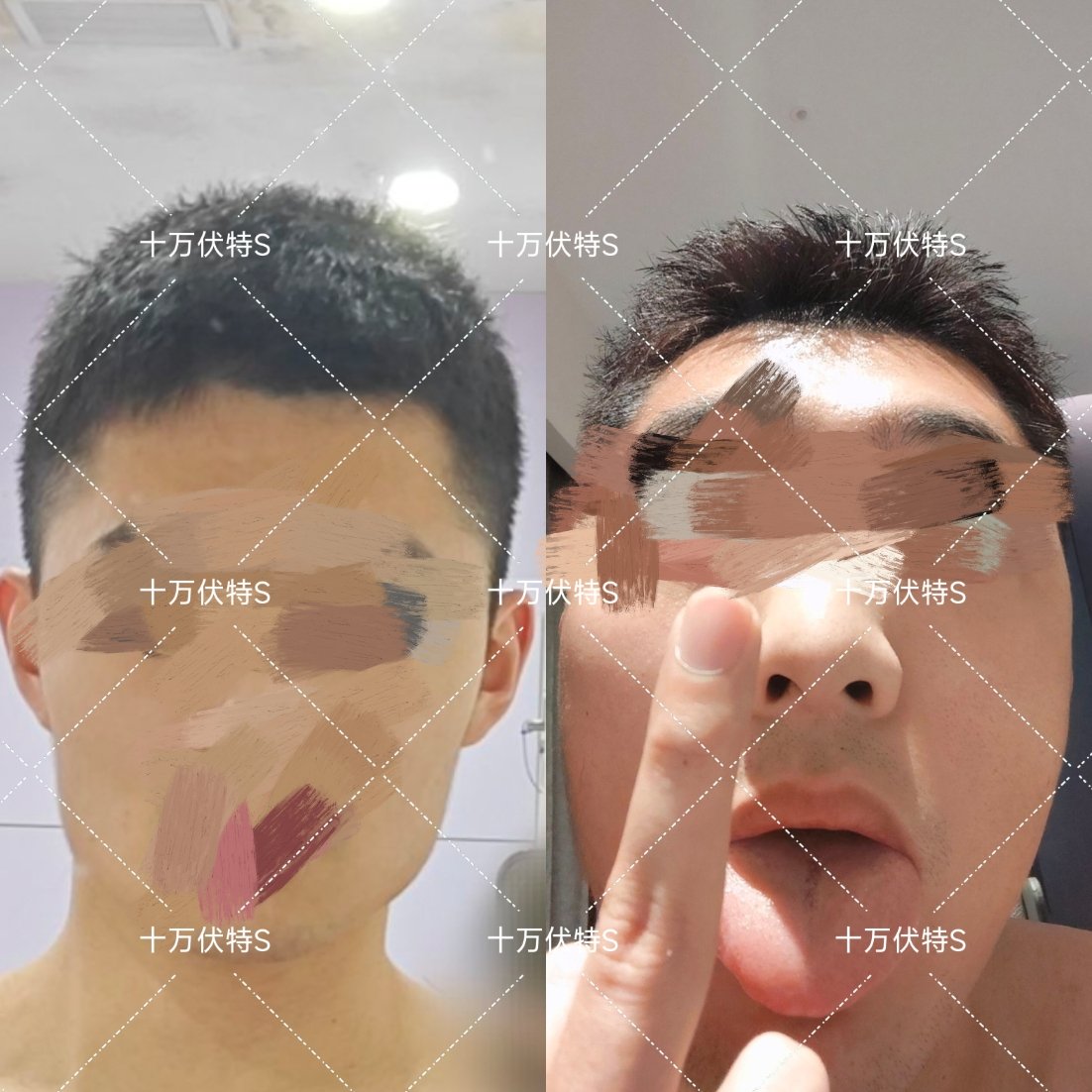 十万伏特S tweet media