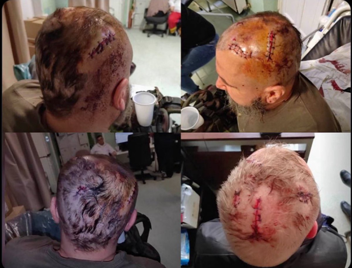 Das sind die Opfer der „Hammerbande. Simeon T. („Maja“) ist ein Gewaltverbrecher. 8 Jahre Gefängnis sind keineswegs zu viel für jemanden wie ihn. Die Solidarisierung der Linken in Deutschland mit ihm verrät viel über deren Gewaltbereitschaft!