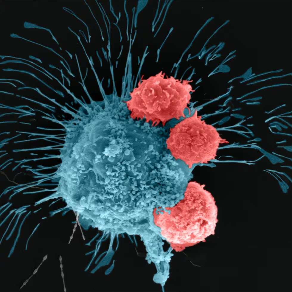 forallcurious's tweet image. 🚨: Russia has announced that its new cancer vaccine, Enteromix, has shown 100% success in clinical trials and is now ready for clinical use.