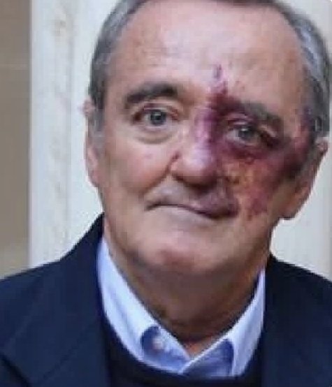 Las dos vertientes Españolas.

Una clase de persona y al lado una persona con clase.