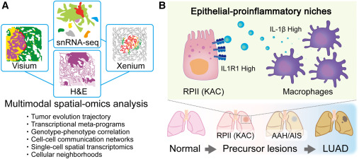 Mapping the inflammatory origins of lung cancer dlvr.it/TQwpRz
