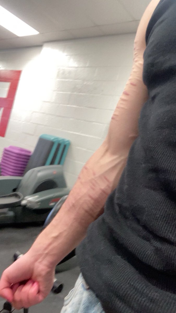 slvtboy3's tweet photo. veins... i love testosterone
#ftm #transmasc #tboy https://t.co/4OSt60I0yF