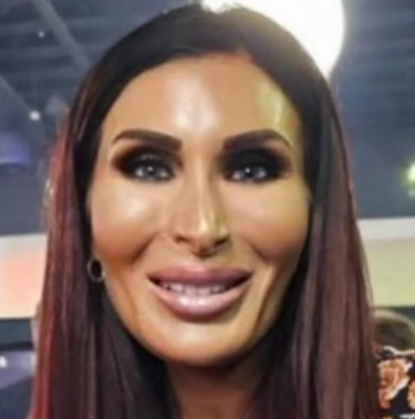 planetpimp's tweet photo. @AnnieForTruth One of these pictures of @LauraLoomer is a Halloween mask. https://t.co/VUc8wfidLo