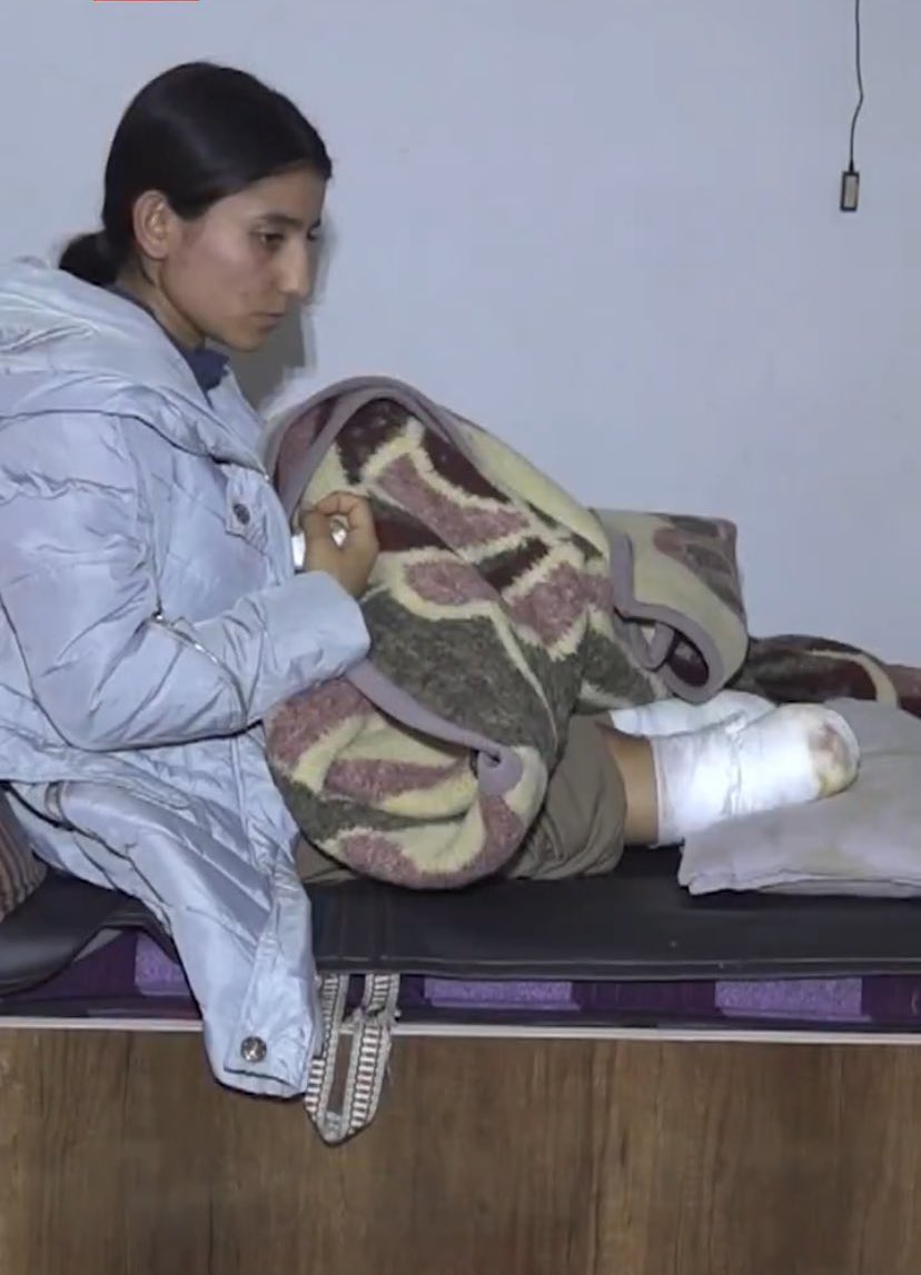 Nazliibrahim77's tweet photo. When the Syrian army bombed her home, Fatima, a Kurdish law student at Kobani University
She lost both her legs in the attack https://t.co/E0OQkQCaPg